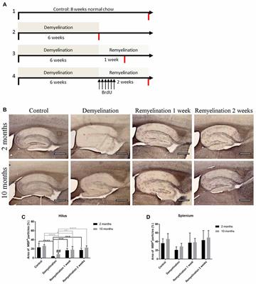 Age Influences Microglial Activation After Cuprizone-Induced Demyelination